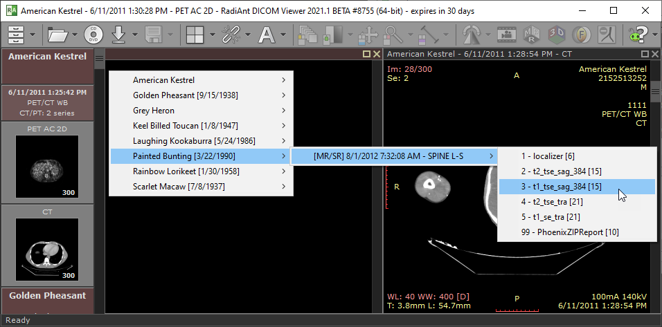 RadiAnt DICOM Viewer Image